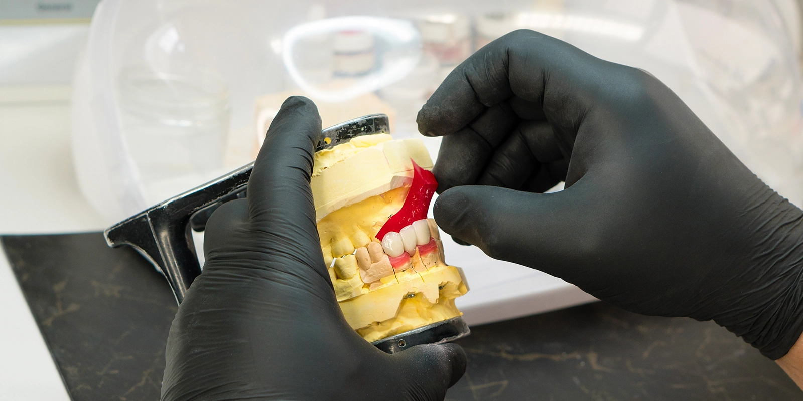 精密な入れ歯ができるまで