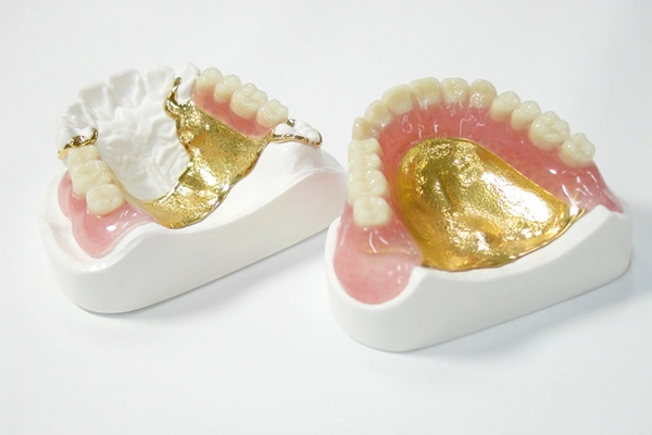 レジン床義歯（部分/総入れ歯）