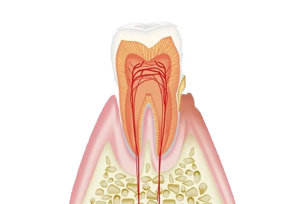 歯肉炎(ごく初期の歯周病)