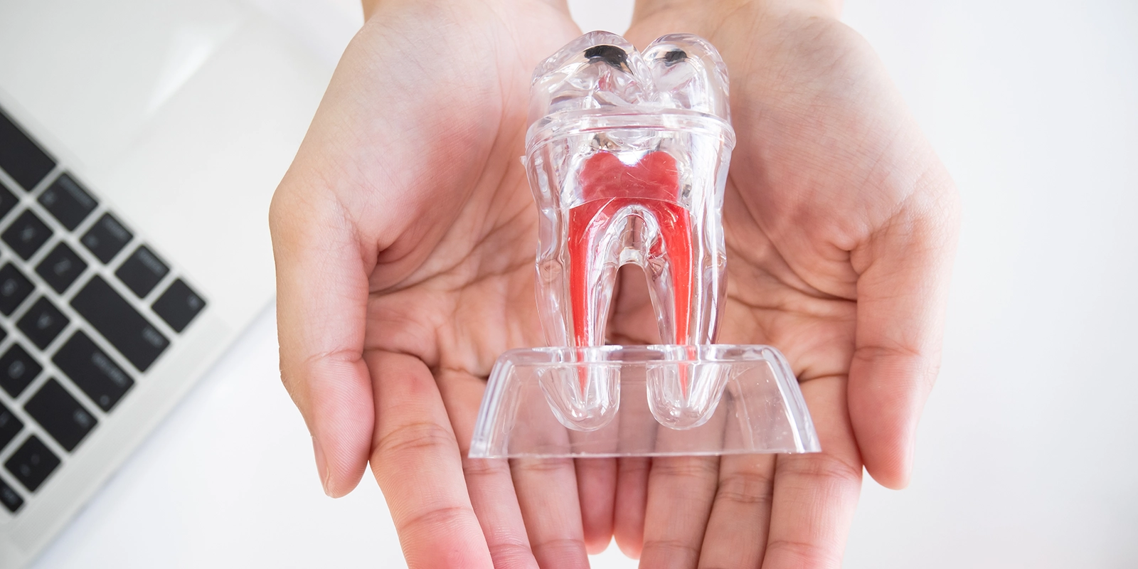 抜歯から歯を守る根管治療