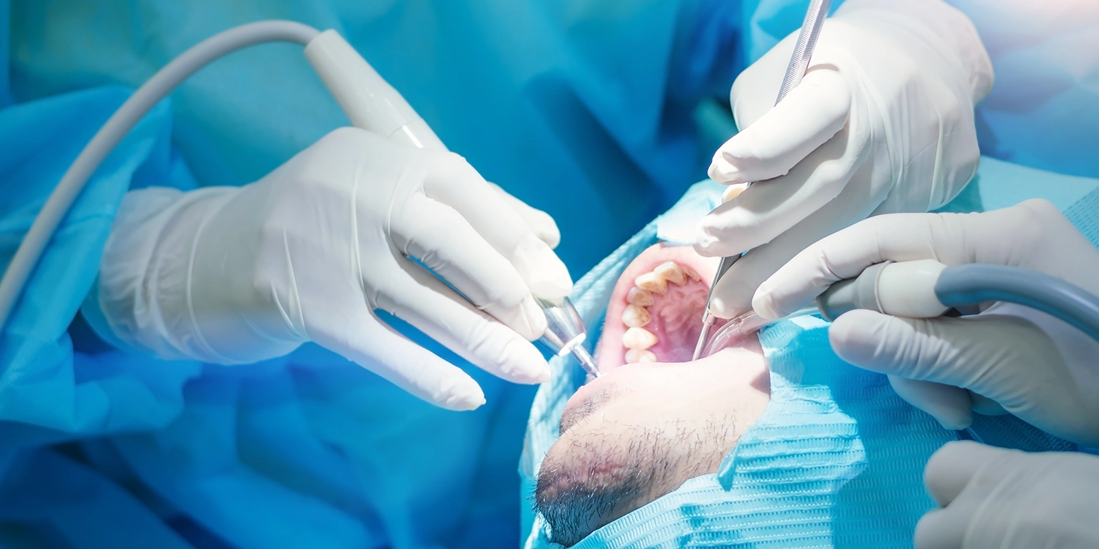 親知らずから顎の悩みまで対応する口腔外科