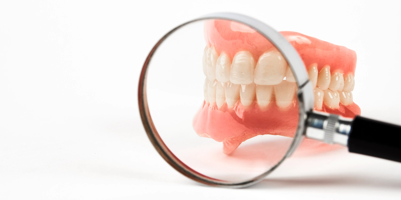 歯を削らないIcon（アイコン）治療