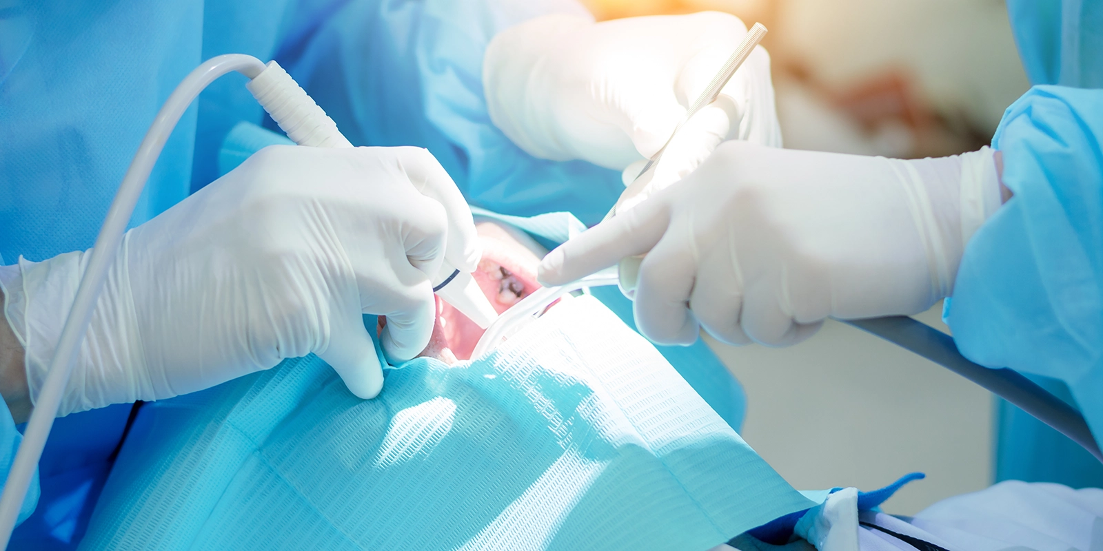 親知らず抜歯の流れ